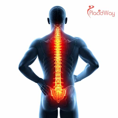 7 Top Benefits of Spine Surgery in Poland